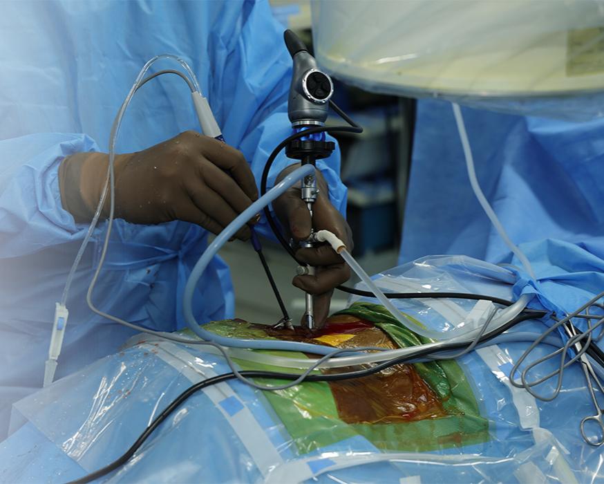 Shameem Hospital Private Limited, Best gastro centre in Madurai, Best gastro hospital in Madurai, Best gastro Doctor in Madurai, Best gastro surgeon in Madurai, Best endoscopy centre in Madurai, Best colonoscopy centre in Madurai, Best ERCP centre in Madurai, Laproscopic hernia centre in Madurai, Best endoscopy centre in Madurai, Best colonoscopy centre in Madurai, Best ERCP centre in Madurai, Laproscopic hernia centre in Madurai, Top Gastro specialist in Madurai, Best Hernia surgeon in Madurai, Best Treatment for Gall Bladder stones in Madurai, Best Piles Surgeon in Madurai, Best stomach specialist in Madurai, Best hepatologist in Madurai,Best liver specialist in Madurai, Best Gastroenterologist in Madurai, Best laparoscopic treatment in Madurai, Best Endoscopy surgery in Madurai, Best Gastroenterology Hospital in Madurai, Best surgeon for varicose veins in Madurai, Best varicose vein surgery in Madurai, Best Laser surgeon for piles in Madurai, Best Spy Glass Cholangioscopy hospital in Madurai, Best Laser surgeon for Varicose veins in Madurai, Best double balloon enteroscopy surgeons in Madurai, Top double balloon enteroscopy surgeons in Madurai, Laser for piles in Madurai, Best surgeon for varicose veins in Madurai, Best varicose vein surgery in Madurai, Best Laser surgeon for piles in Madurai, Top Laser surgeon for piles in Madurai, Best Spy Glass Cholangioscopy in Madurai, Best Spy Glass Cholangioscopy hospital in Madurai, Best Laser surgeon for Varicose veins in Madurai, Top Laser surgeon for varicose veins in Madurai, Best double balloon enteroscopy surgeons in Madurai, Top double balloon enteroscopy surgeons in Madurai,piles Treatment in Madurai, stones Treatment in Madurai, hernia Treatment in Madurai, stomach Treatment in Madurai, liver Treatment in Madurai, varicose veins Treatment in Madurai.